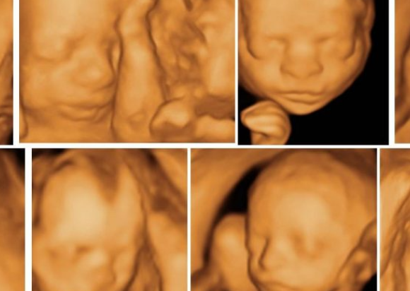 Best Fetal Medicine Centre in Jaipur