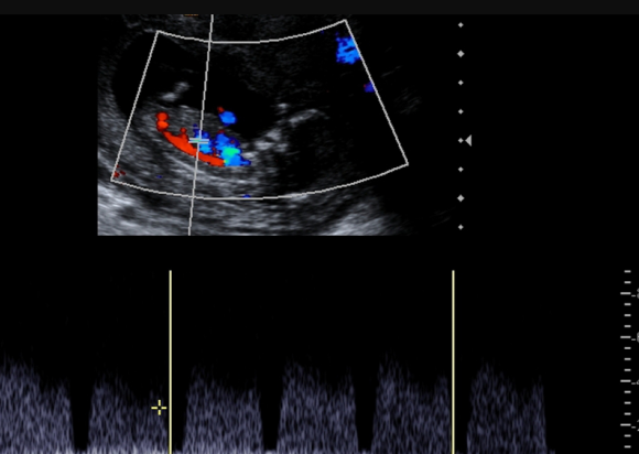 Best Fetal Medicine Centre in Jaipur